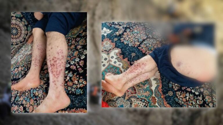 برینداربوونی چوار كۆڵبه‌ر له‌ سنووری بانه