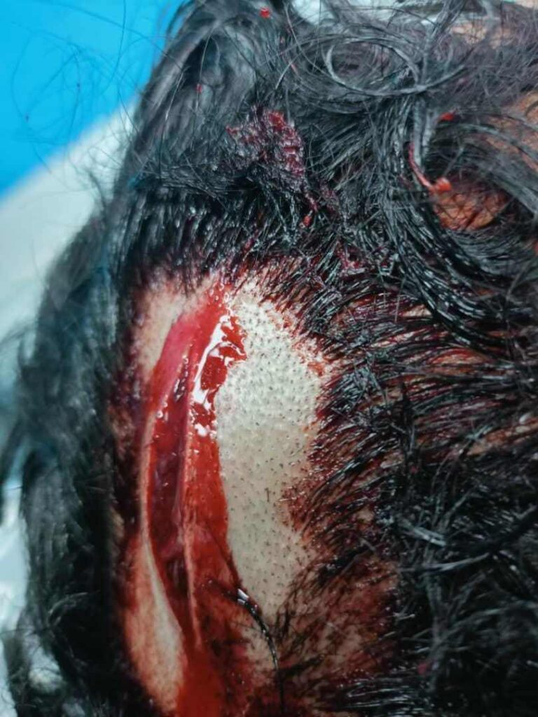 هێرشی سه‌له‌فییه‌كان بۆ سه‌ر هاووڵاتییه‌ك له‌ سه‌قز
