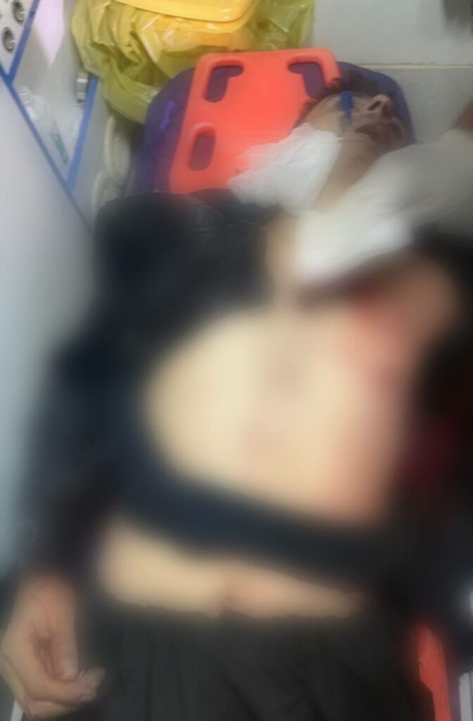 گیانله‌ده‌ستدانو برینداربوونی دوو كۆڵبه‌ر له‌ ناوچه‌ سنوورییه‌كانی بانه‌