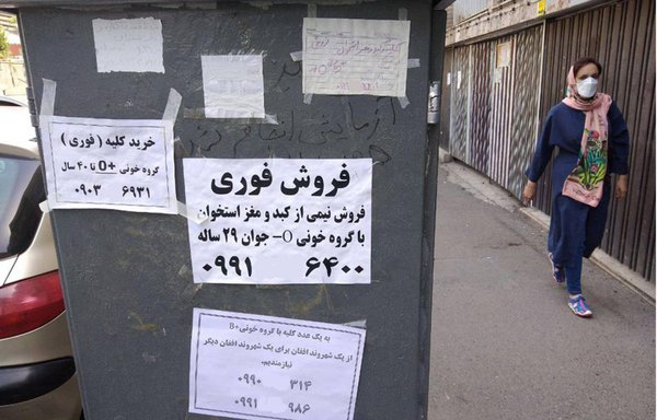 فروش اعضای بدن بدلیل فقر